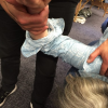 Neurodynamic Assessment of the Brachial Plexus in action